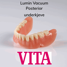 Lumin Vacuum Posterior protesetenner 8 stk UK