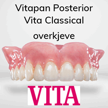 Vitapan Posterior protesetenner 6 stk Vita Classical OK