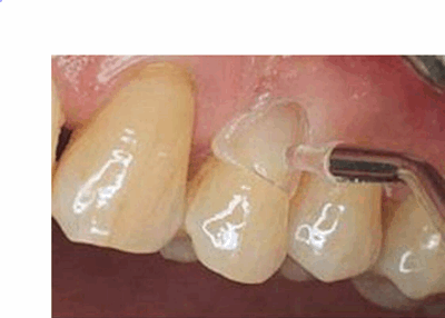 19640 prod19740_1_1.PNG