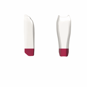 Bioclear Black Triangle Matriser Liten Rosa 20 stk