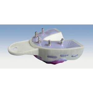 Miratray Implant avtrykkskje engangs I1 UK Small 6 stk
