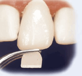 10815 prod00215_1.png