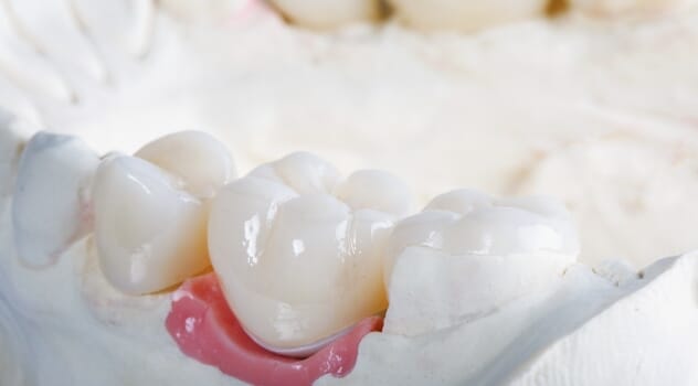 Krone- og bromaterialer