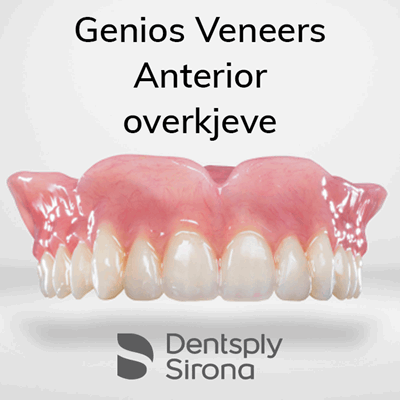 V900012 Genios Veneers ANt OK.png
