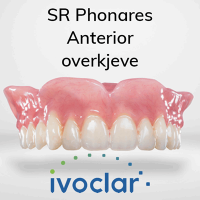 V900016 SR Phonares Ant OK_1.png