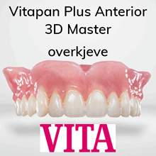 Vitapan Plus Anterior protesetenner 6 stk 3D Master OK