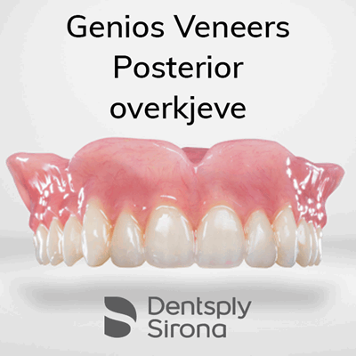 V900014 Genios Veneers Post OK.png