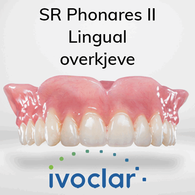 V900018 SR Phonares II Lingual OK_1.png