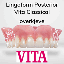 Lingoform Posterior protesetenner 8 stk Vita Classical OK
