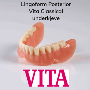 Lingoform Posterior protesetenner 8 stk Vita Classical UK